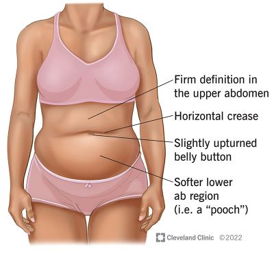 Undergarment to hold in stomach discount